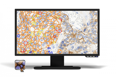 MembraneQuant
