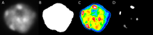 A DAPI-stained nucleus at left, followed by a white segmentation mask, a false-color heatmap, and segmented heterochromatin blocks.