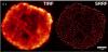 Comparison TIRF - SRRF