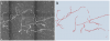 Example_TReMAP_Result