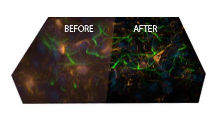 Image restoration with AutoQuant