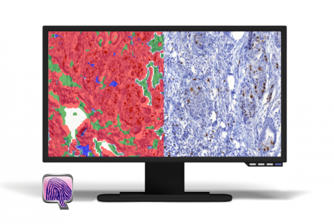 PatternQuant