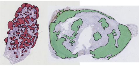 Segmentation illustration