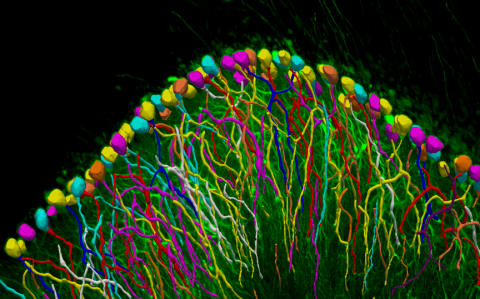 Neurolucida example