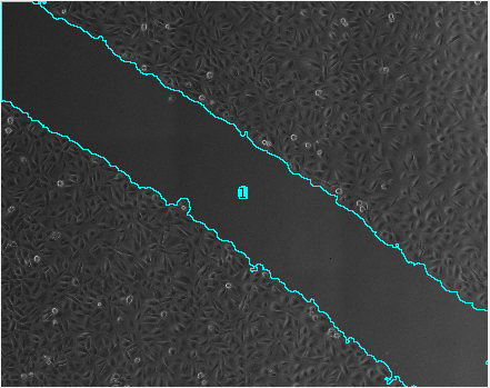 Measure area of the wound