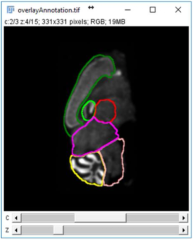 Example: SliceMaps brain region segmentation