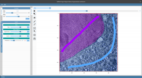 User interface of SuRVoS showing example annotation on soft x-ray tomography data