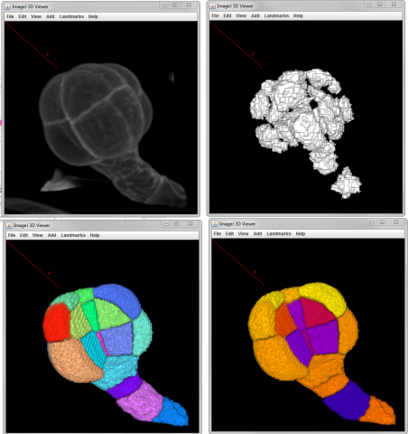 several steps of morphological segmentation of plant tissue using MorphoLibJ.