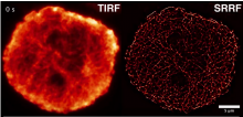 Comparison TIRF - SRRF