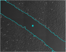 Measure area of the wound