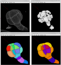 several steps of morphological segmentation of plant tissue using MorphoLibJ.