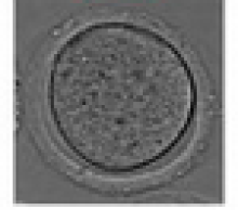Oocyte image