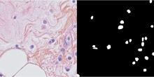 Example of Histopathology image and matched ground truth